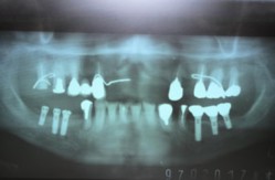 04.jpg